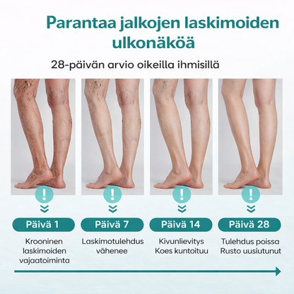 VenaLievä™ – Mikroneulalaastari raskaiden jalkojen ja suonten tueksi