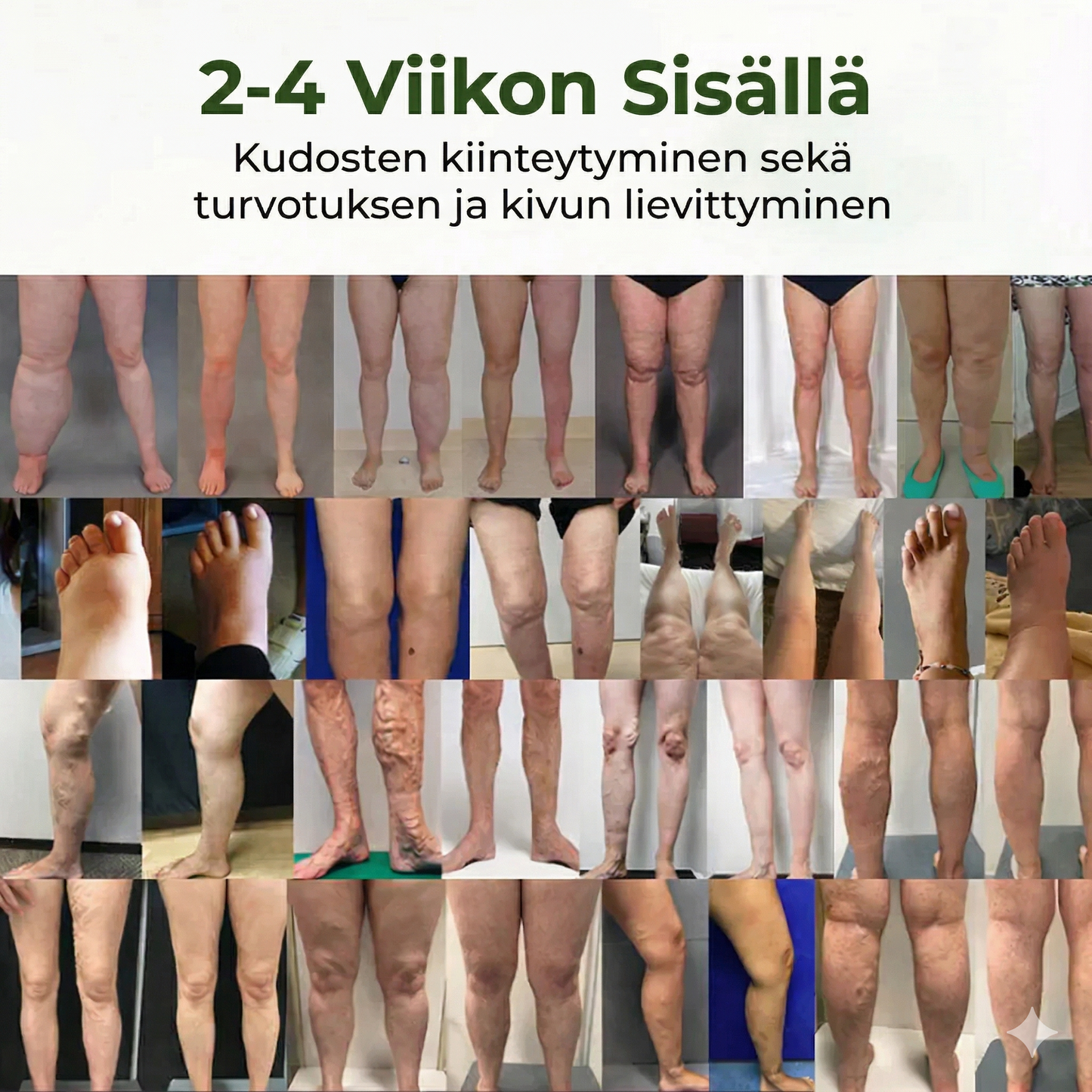 VirtaVoima™ – Verenkierron tehostus jaloille