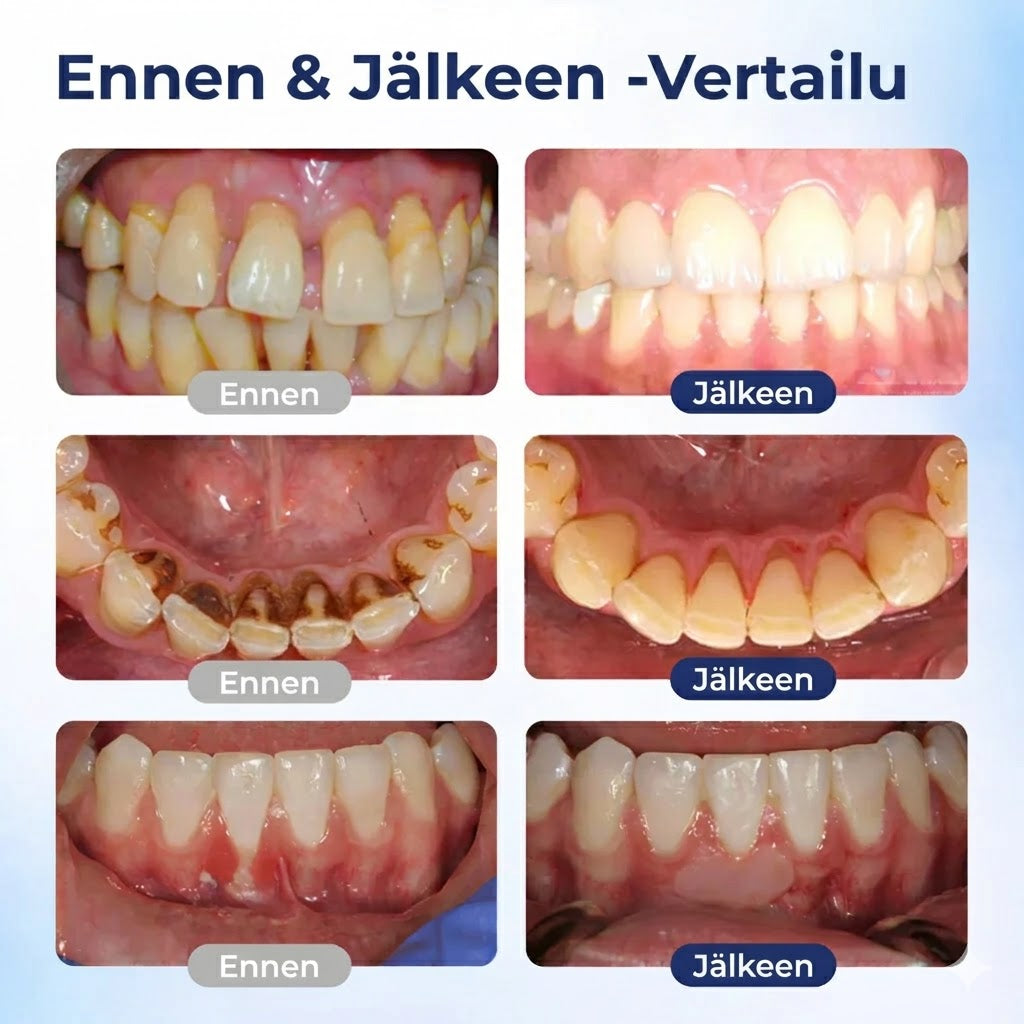 HammasVoima™ – Hampaiden ja ikenien vahvistus